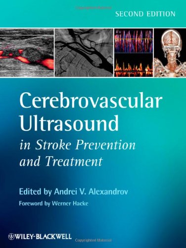 Cerebrovascular Ultrasound in Stroke Prevention and Treatment  2nd 2011 9781405195768 Front Cover