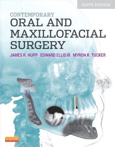 Contemporary Oral and Maxillofacial Surgery  6th 2014 9780323091770 Front Cover