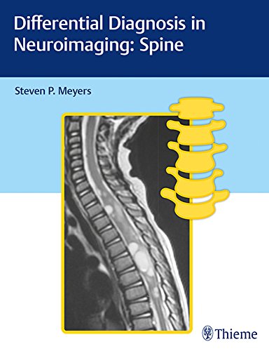 Differential Diagnosis in Neuroimaging: Spine   2017 9781626234772 Front Cover