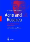 Acne and Rosacea 2nd 1993 (Revised) 9780387522777 Front Cover