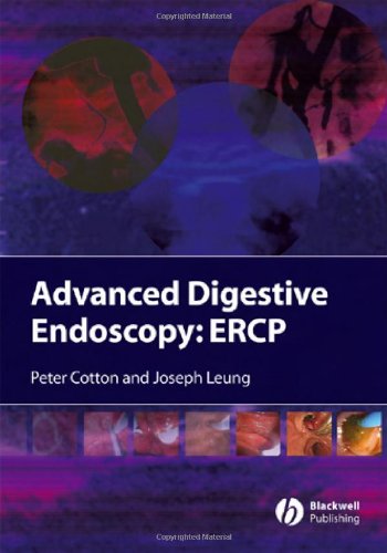 Advanced Digestive Endoscopy ERCP  2005 (Revised) 9781405120791 Front Cover