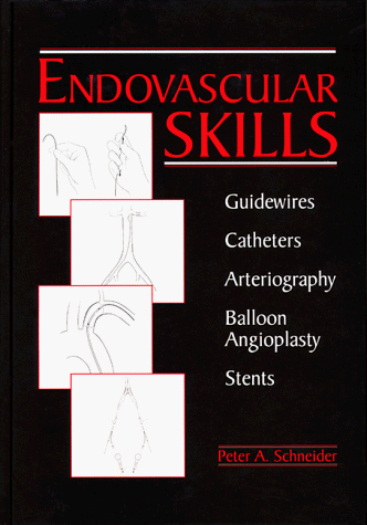 Endovascular Skills Guidewires, Catheters, Arteriography, Balloon Angioplasty, Stents N/A 9781576260791 Front Cover