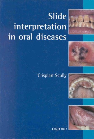 Slide Interpretation in Oral Diseases  2nd 1999 (Revised) 9780192630810 Front Cover