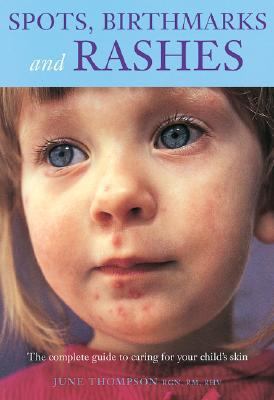 Spots, Birthmarks and Rashes The Complete Guide to Caring for Your Child's Skin  2003 9781552976814 Front Cover