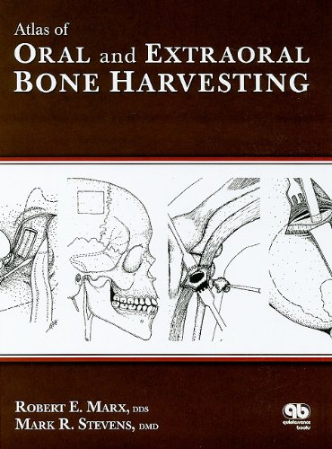 Atlas of Oral and Extraoral Bone Harvesting  2010 9780867154825 Front Cover