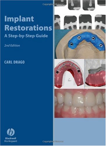 Implant Restorations A Step-by-Step Guide 2nd 2007 (Revised) 9780813828831 Front Cover