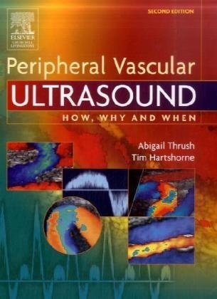 Peripheral Vascular Ultrasound How, Why and When 2nd 2005 (Revised) 9780443072833 Front Cover