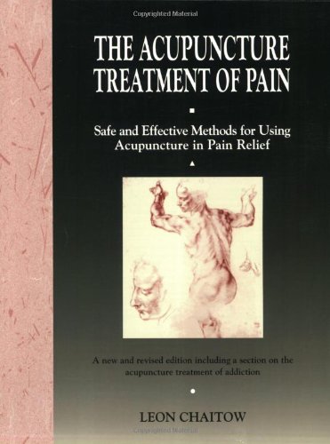 Acupuncture Treatment of Pain Safe and Effective Methods for Using Acupuncture in Pain Relief 2nd 9780892813834 Front Cover