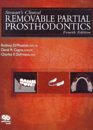 Stewart's Clinical Removable Partial Prosthodontics  4th 2008 9780867154856 Front Cover
