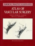 Atlas of Vascular Surgery  1989 9780443084867 Front Cover