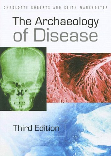 Archaeology of Disease  3rd 2007 (Revised) 9780801473883 Front Cover