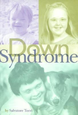 Down Syndrome   2000 9780531115893 Front Cover