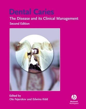 Dental Caries The Disease and Its Clinical Management 2nd 2008 (Revised) 9781405138895 Front Cover
