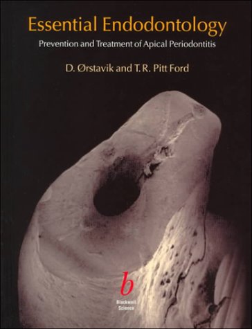 Essential Endodontology Prevention and Treatment of Apical Periodontitis  1998 9780632040896 Front Cover