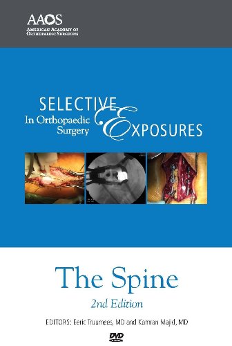 Selective Exposures in Orthopaedic Surgery: The Spine  2011 9780892035922 Front Cover