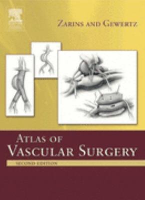 Atlas of Vascular Surgery  2nd 2005 (Revised) 9780443065927 Front Cover