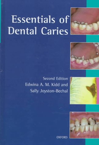 Essentials of Dental Caries The Disease and Its Management 2nd 1996 (Revised) 9780192626929 Front Cover
