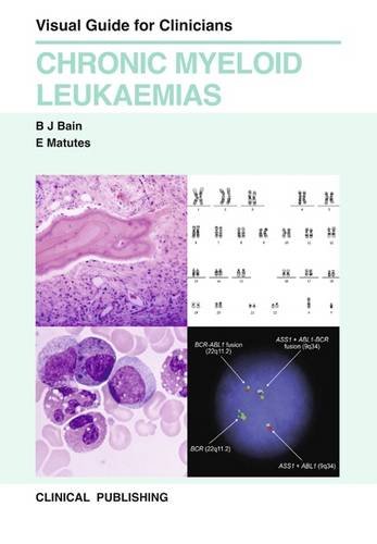 Chronic Myeloid Leukaemias Visual Guide for Clinicians  2013 9781846920943 Front Cover