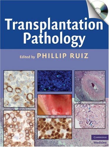 Transplantation Pathology   2009 9780521879958 Front Cover