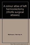 Color Atlas of Left Hemicolectomy  1986 9780815157960 Front Cover