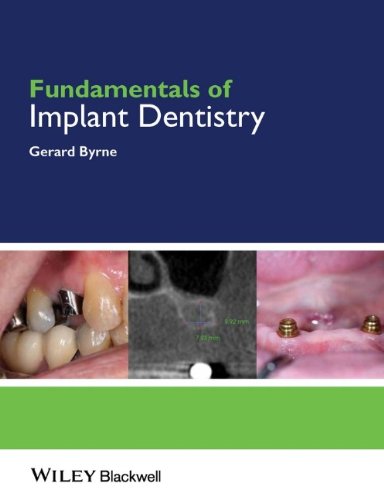 Fundamentals of Implant Dentistry   2014 9781118274965 Front Cover