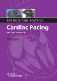 Nuts and Bolts of Cardiac Pacing 