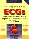 Complete Guide to ECGs 