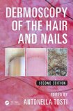 Dermoscopy of the Hair and Nails:  9781482234053 Front Cover