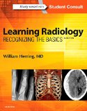 Learning Radiology Recognizing the Basics cover art