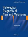 Histological Diagnosis of Nevi and Melanoma 2nd 9783642373107 Front Cover
