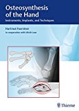 Osteosynthese der Hand 2016 9783132038110 Front Cover