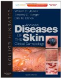 Andrews' Diseases of the Skin Clinical Dermatology 11th 9781437703146 Front Cover