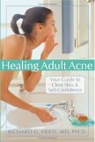 Healing Adult Acne Your Guide to Clear Skin and Self-Confidence 2005 9781572244153 Front Cover