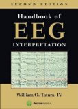Handbook of EEG Interpretation  cover art