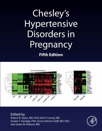 Chesley's Hypertensive Disorders in Pregnancy 5th 9780128184172 Front Cover