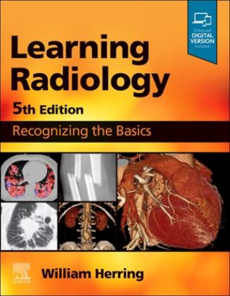 Learning Radiology Recognizing the Basics 5th 9780323878173 Front Cover