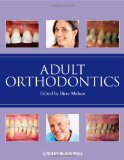 Adult Orthodontics 2012 9781405136198 Front Cover