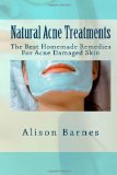 Natural Acne Treatments The Best Homemade Remedies for Acne Damaged Skin 2012 9781475222227 Front Cover