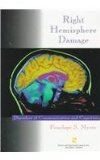 Right Hemisphere Damage Disorders of Communication and Cognition 1998 9781565932241 Front Cover