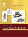 Atlas of Vascular Surgery - Paperback Edition 2nd 2009 9781437722253 Front Cover