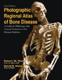 Photographic Regional Atlas of Bone Disease A Guide to Pathologic and Normal Variation in the Human Skeleton 3rd 9780398088262 Front Cover