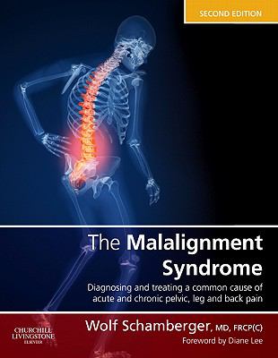 Malalignment Syndrome Diagnosis and Treatment of Common Pelvic and Back Pain