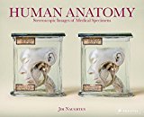 Human Anatomy Stereoscopic Images of Medical Specimens  9783791383293 Front Cover