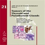 Tumors of the Thyroid Glands:  9781933477329 Front Cover