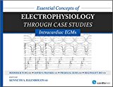 Essential Concepts of Electrophysiology Through Case Studies Intracardiac EGMs  9781935395331 Front Cover