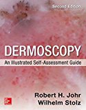 Dermoscopy: An Illustrated Self-assessment Guide