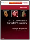Atlas of Cardiovascular Computed Tomography  9781416061366 Front Cover