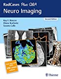 RadCases Plus Q&amp;a Neuro Imaging 2nd 9781626232372 Front Cover