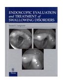 Endoscopic Evaluation and Treatment of Swallowing Disorders 2nd 9780865778382 Front Cover