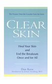 Clear Skin Heal Your Skin and End the Breakouts- Once and for All 2004 9780399529481 Front Cover